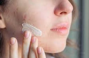 Salicylic Acid for Acne: How to Use It for the Best Results