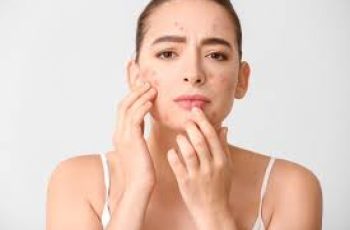 Skincare Strategies for Managing Menopausal Acne and Skin Changes