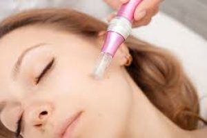 Revitalize Your Skin: Microneedling Rollers for Acne Scars