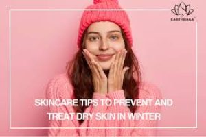 Winter Skincare Tips for Preventing and Treating Dry Skin