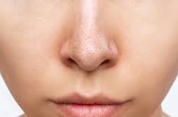 How to Keep Your Nose Clear of Blackheads Daily