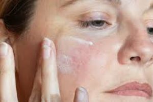 Top Dermatologist-Recommended Moisturizers for Rosacea and Sensitive Skin