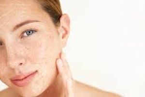 How to Heal and Prevent Over-Exfoliated Skin Damage