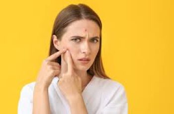 Can Kissing Cause Acne? What Dermatologists Want You to Know Can Kissing Cause Acne? What Dermatologists Want You to Know