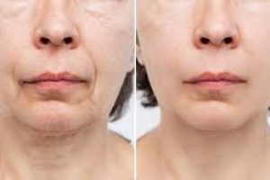 Skincare Solutions to Firm and Tighten Loose, Sagging Skin