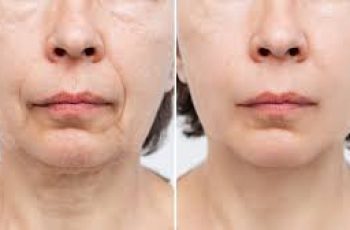 Skincare Solutions to Firm and Tighten Loose, Sagging Skin