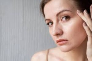 Uneven Skin Tone Explained: How to Identify, Treat, and Prevent Pigmentation Issues