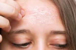 Dealing with Dry Skin: Why Patches Appear and How to Fix Them