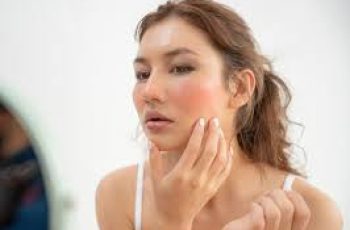 Gentle Skincare Routine to Calm and Protect Rosacea-Prone Skin