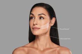 Skincare Meets Surgery: Inside the Buccal Fat Removal Craze