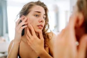 Skin Purging Explained: Causes, Timeline, and Clear Skin Tips