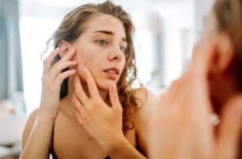 Skin Purging Explained: Causes, Timeline, and Clear Skin Tips Skin Purging Explained: Causes, Timeline, and Clear Skin Tips