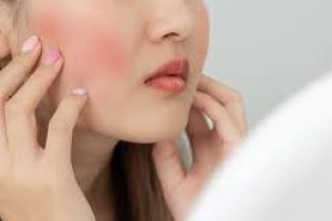 Essential Skincare Ingredients to Avoid and Embrace for Rosacea Care