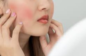 Essential Skincare Ingredients to Avoid and Embrace for Rosacea Care Essential Skincare Ingredients to Avoid and Embrace for Rosacea Care