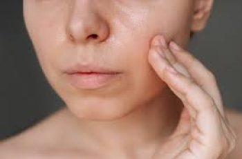 What You Need to Know About Oily Skin: Causes, Care, and Treatment What You Need to Know About Oily Skin: Causes, Care, and Treatment