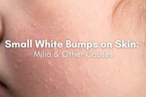 White Bumps on Skin? 7 Reasons and What To Do