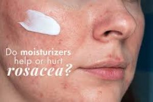 Gentle Rosacea Cleansers: Soothing Flare-Ups for Sensitive Skin