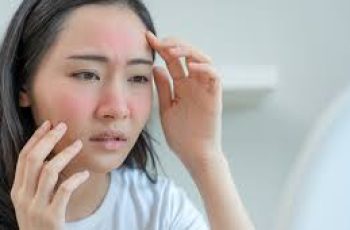 Skincare Guide to Calm and Treat Blotchy, Red Skin